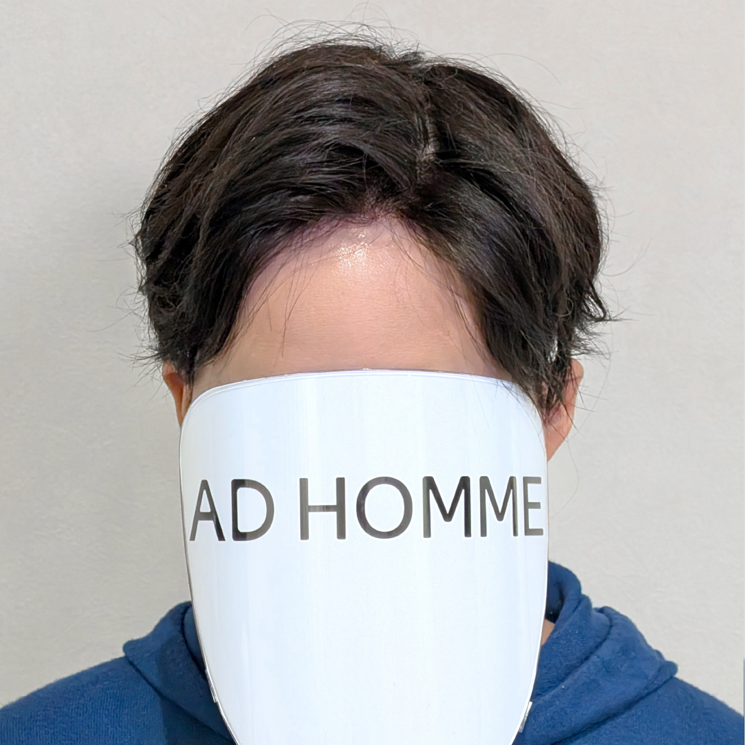 メンズウィッグ・かつら着用後写真【ブラウンメッシュナチュラルスタイル】