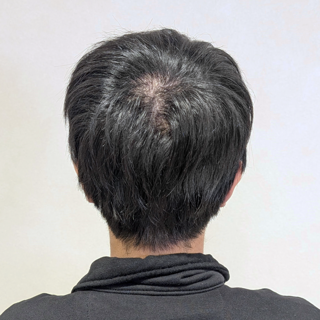 メンズウィッグ・かつら着用前写真【ゆるパーマショートスタイル】