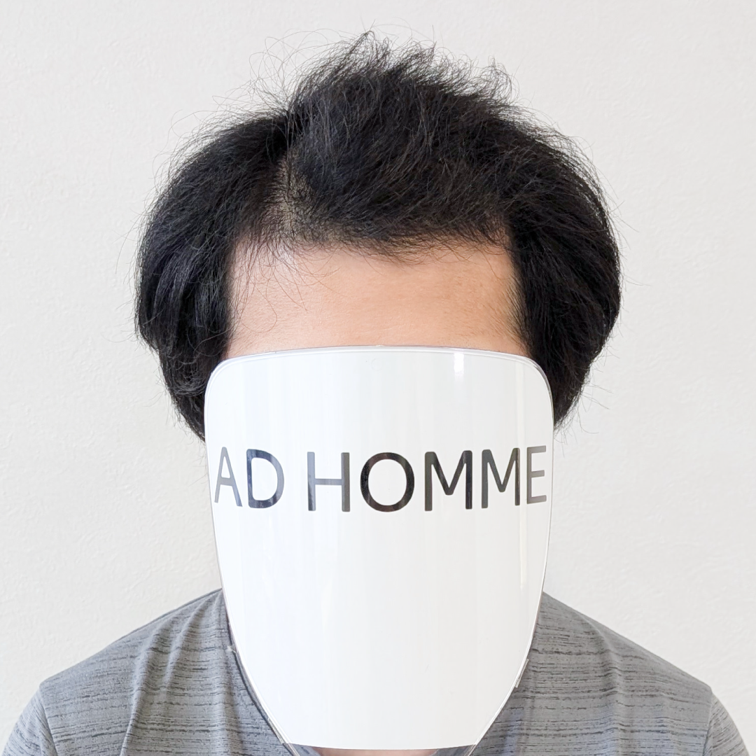 メンズウィッグ・かつら着用前写真【ナチュラルスパイラルかきあげスタイル】