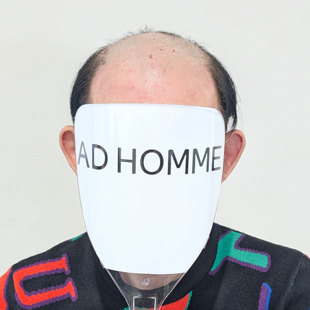 メンズウィッグ・かつら着用前写真【分け流し オールバックスタイル】