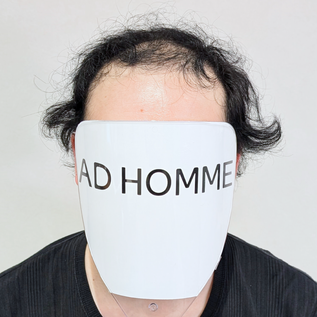 メンズウィッグ・かつら着用前写真【サイドパートクセ毛風パーマスタイル】