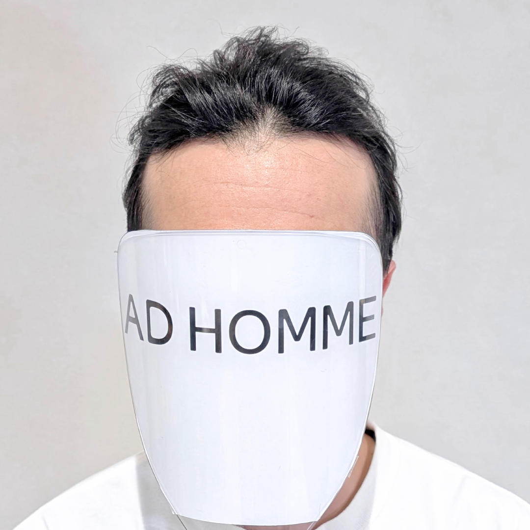 メンズウィッグ・かつら着用前写真【軽めナチュラルショートスタイル】