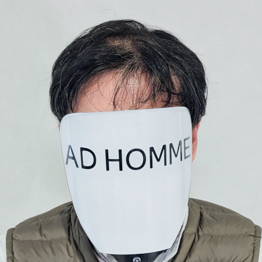 メンズウィッグ・かつら着用前写真【無造作パーマスタイル】