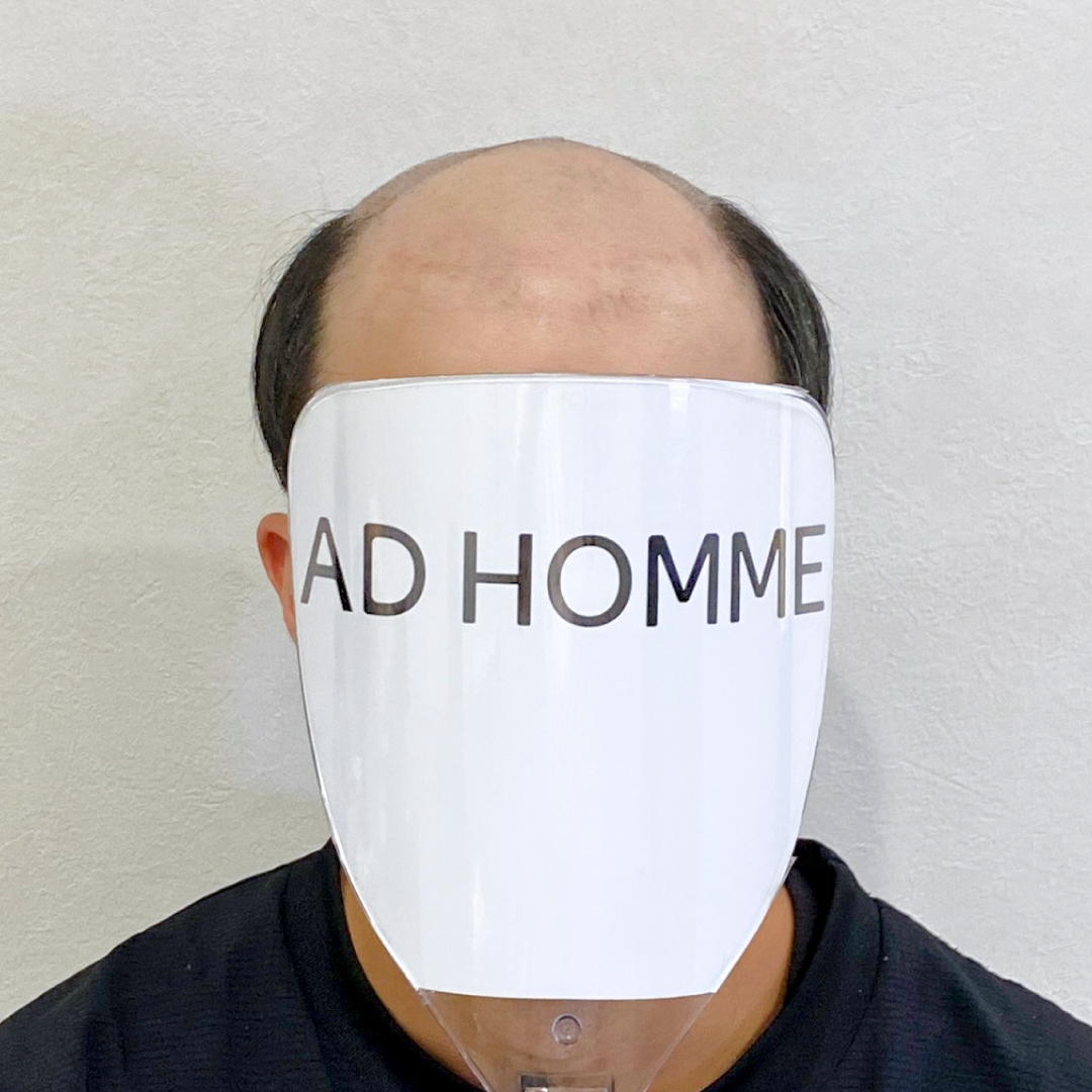 メンズウィッグ・かつら着用前写真【ソフトツーブロックパーマスタイル】