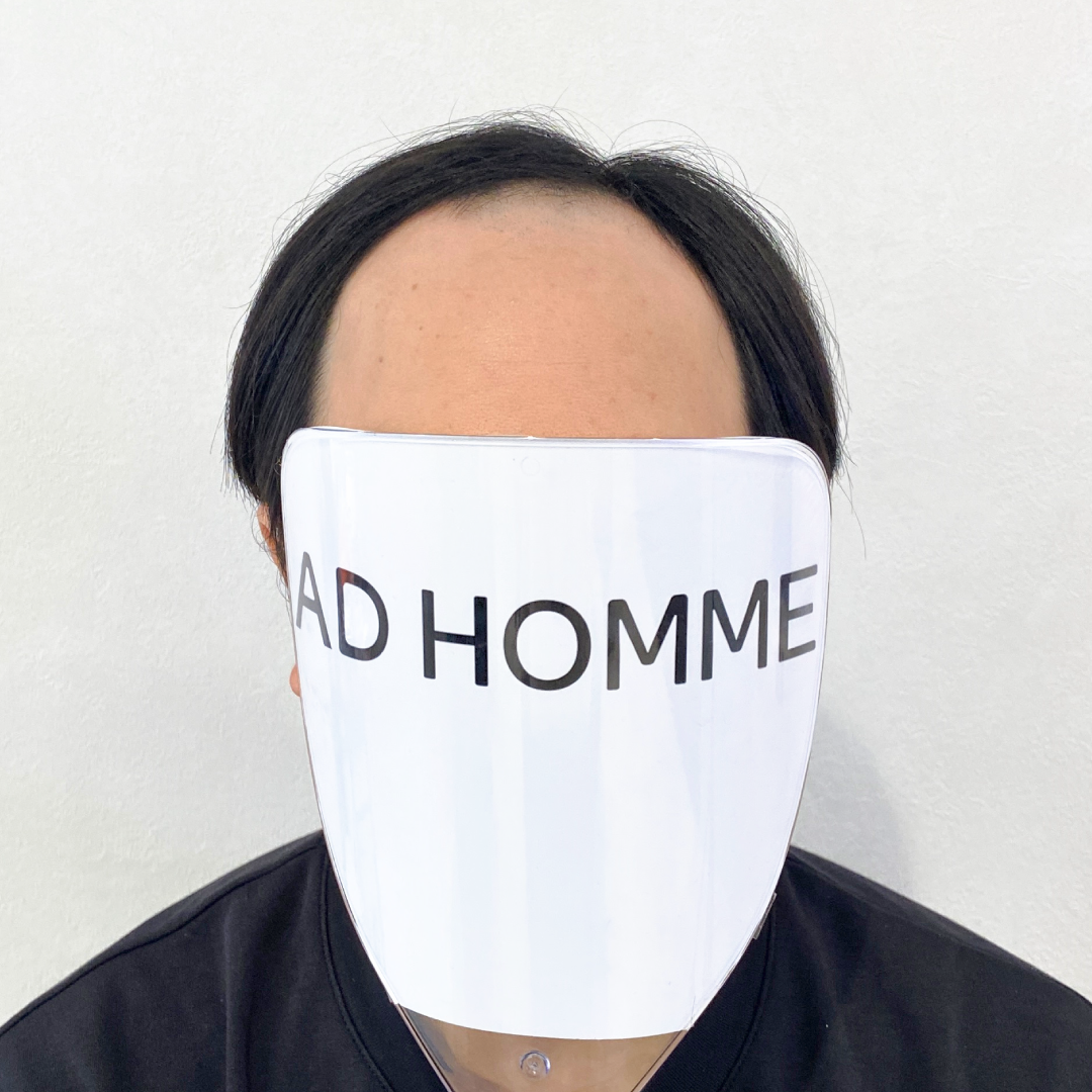 メンズウィッグ・かつら着用前写真【ソフトパーマナチュラルスタイル】