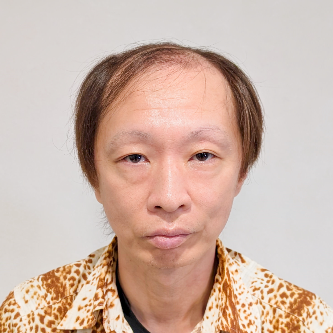 メンズウィッグ・かつら着用前写真【茶髪×軽めショートスタイル】