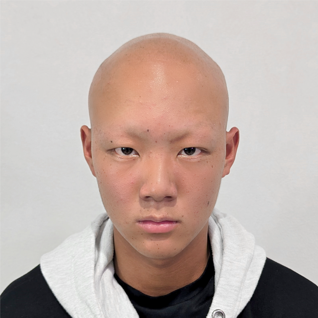 メンズウィッグ・かつら着用前写真【ベリーショートスタイル（フルウィッグ / 全体かつら）】