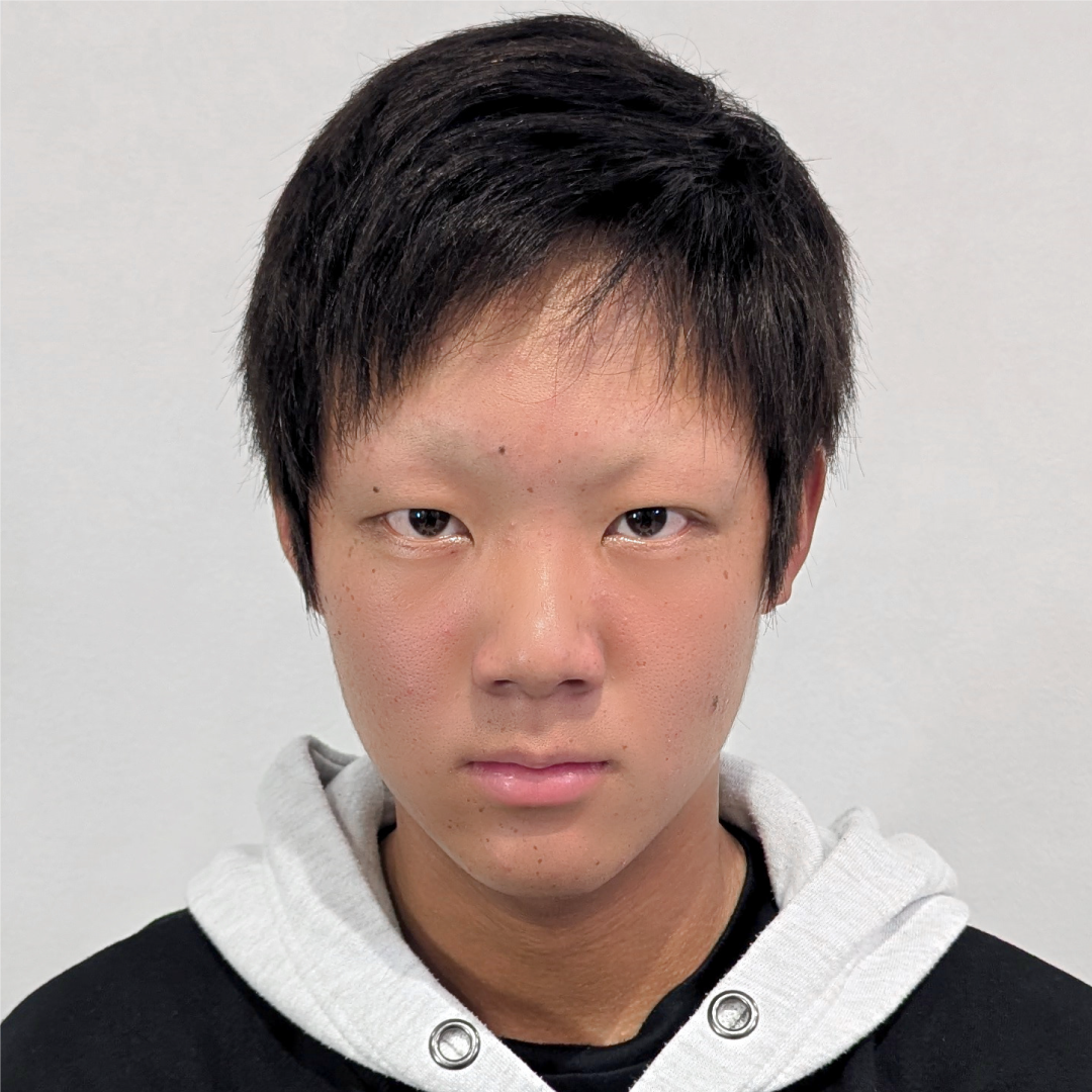 メンズウィッグ・かつら着用後写真【ベリーショートスタイル（フルウィッグ / 全体かつら）】