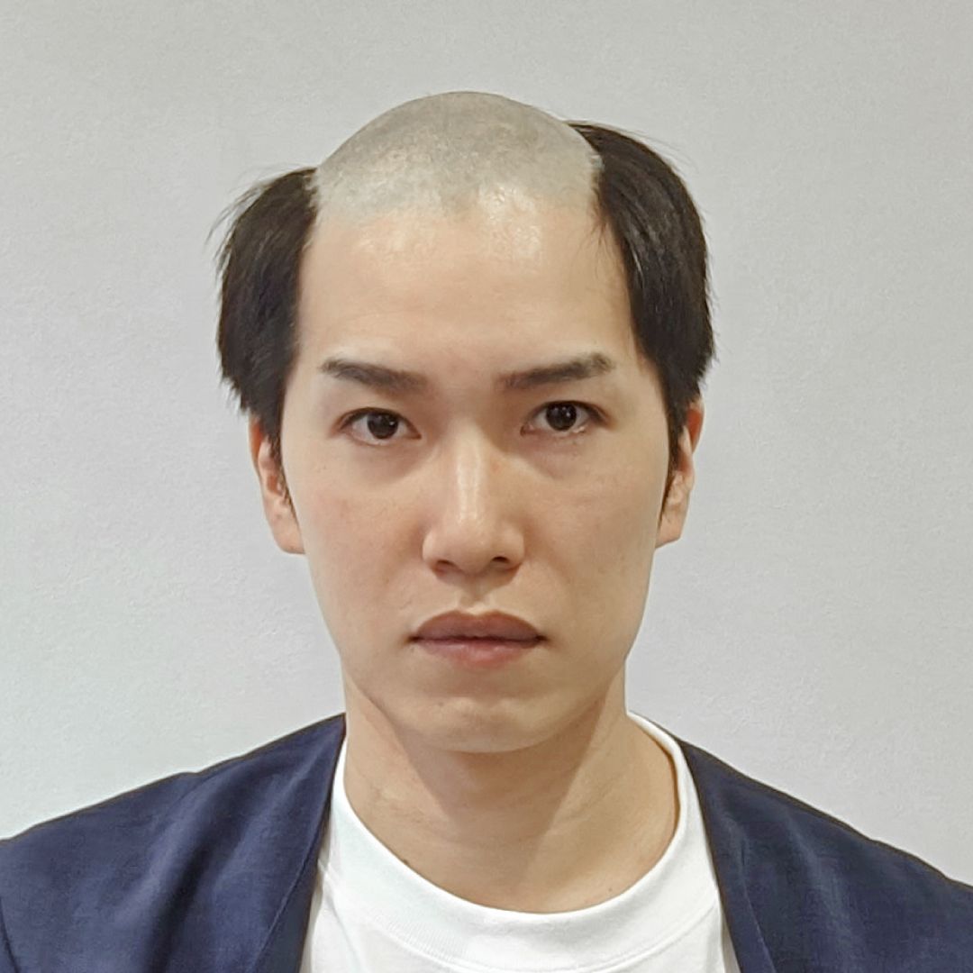 メンズウィッグ・かつら着用前写真【シンプルショートスタイル】