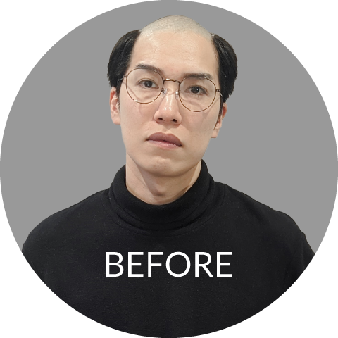 メンズウィッグ・かつら装着前