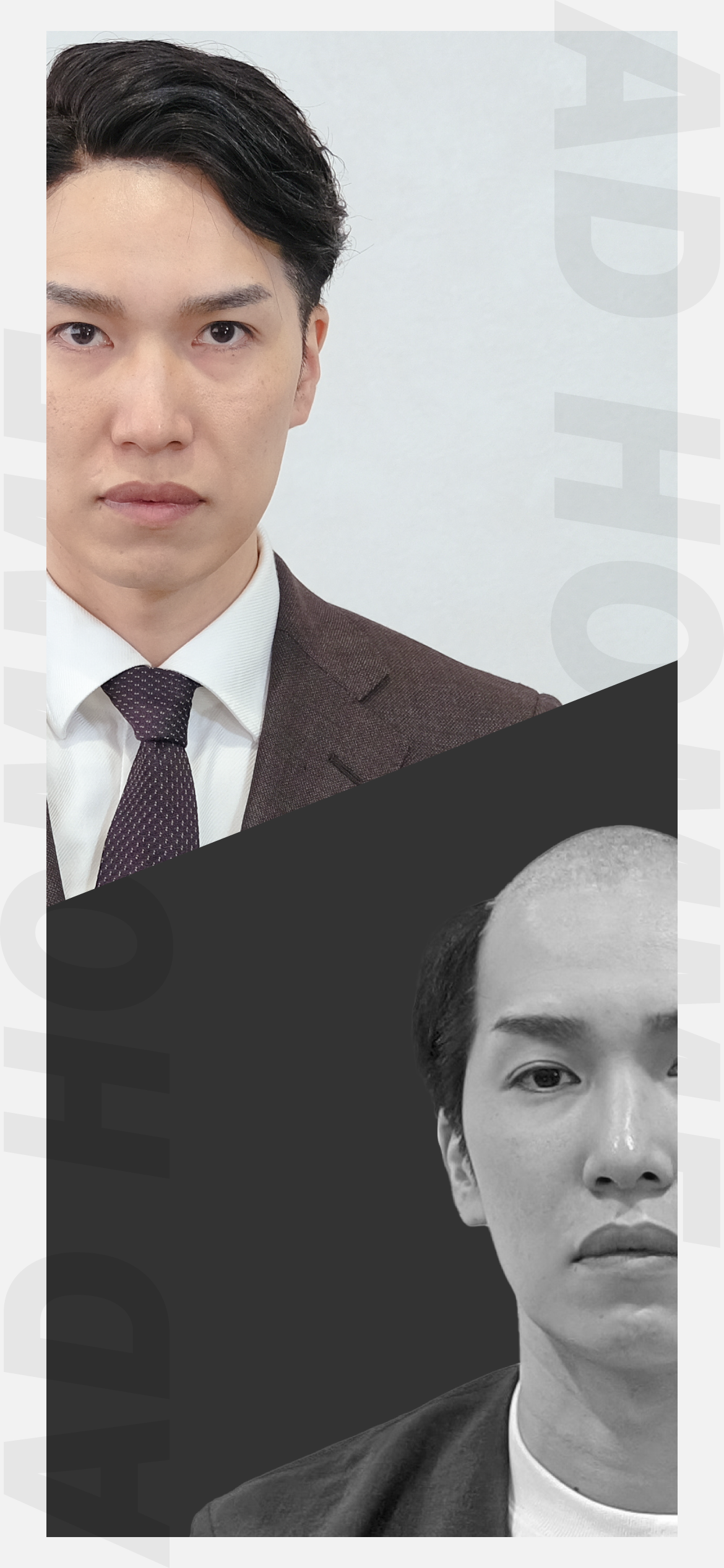 メンズウィッグ・かつら装着前・装着後